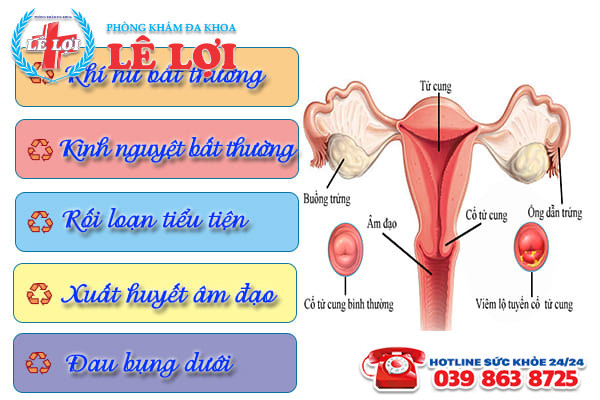 Các biểu hiện của viêm lộ tuyến cổ tử cung