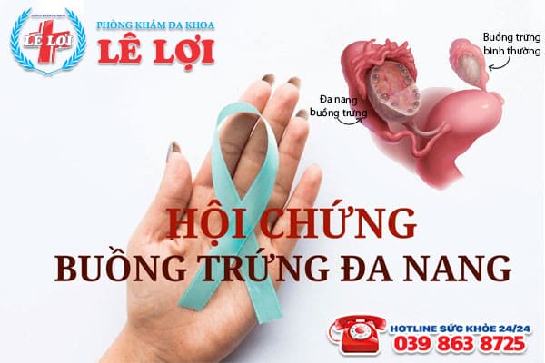 địa chỉ chữa đa nang buồng trứng rẻ nhất tại TP Vinh Nghệ An