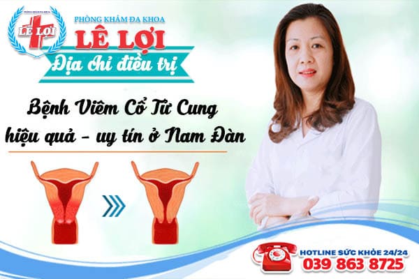 địa chỉ chữa viêm cổ tử cung hiệu quả ở Nghệ An